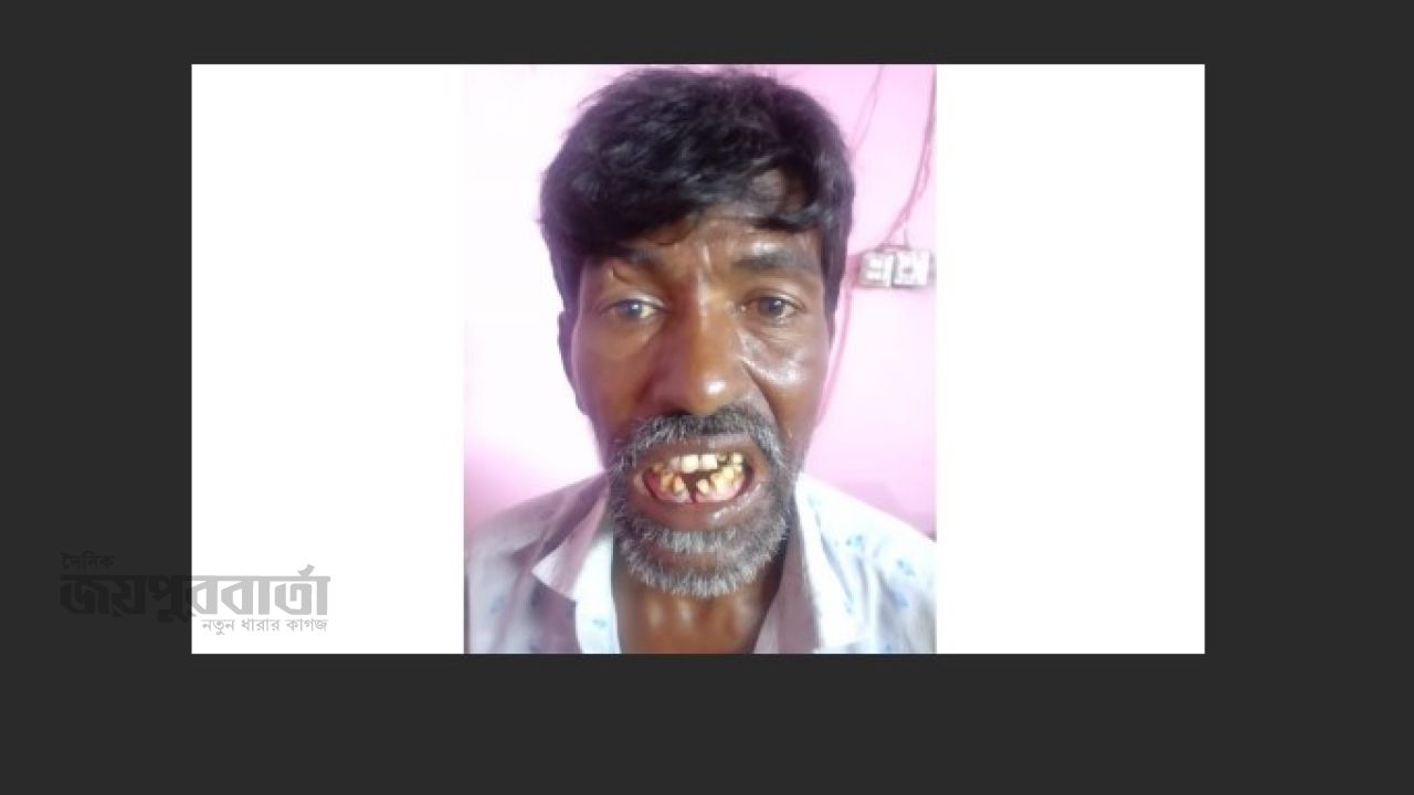 কুতুবদিয়ায় রিক্সা চালককে  হাতুড়ি ও লোহার রড দিয়ে পিটিয়ে জখম