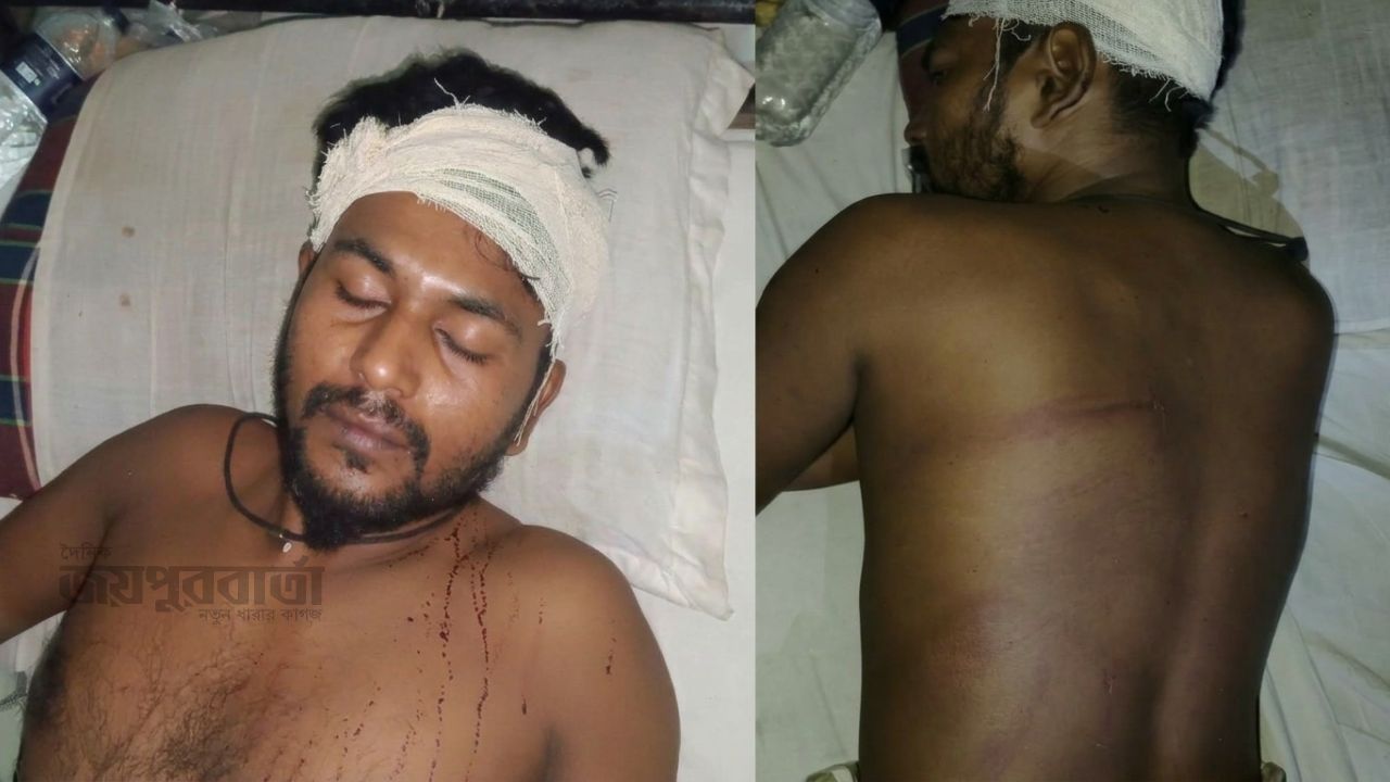 মান্দায় পূর্ব বিরোধের জেরে যুবককে কোপ,থানায় অভিযোগ